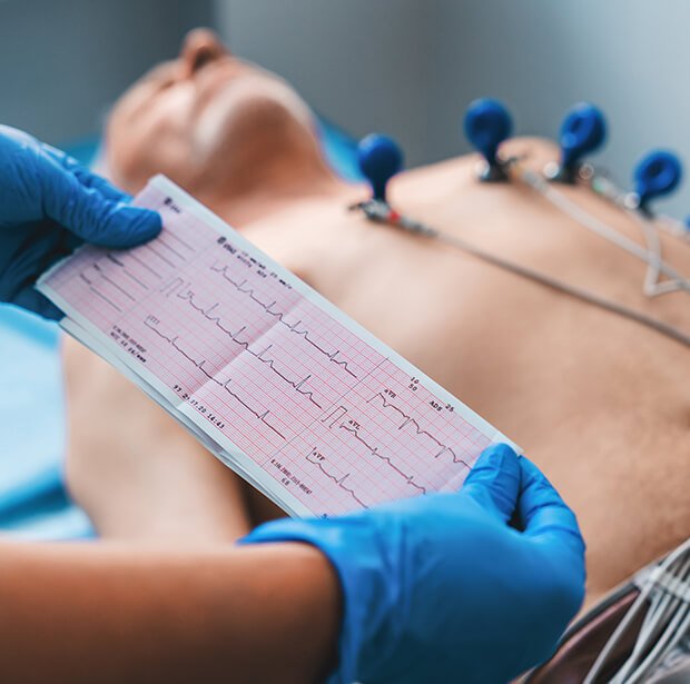 Electrocardiograma Medilife